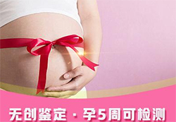 杭州怀孕了如何办理孕期亲子鉴定，杭州办理无创孕期亲子鉴定多少钱